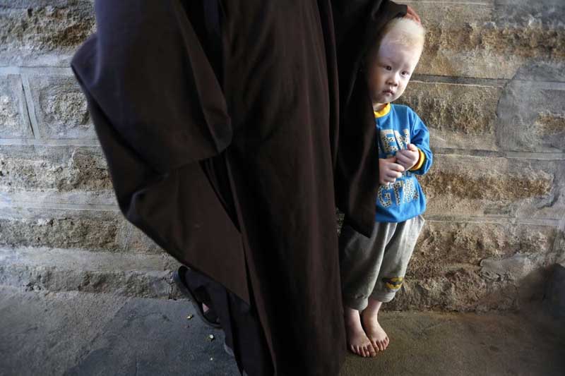 Un ni?o adoptado albino se esconde bajo la sotana de una monja, el 27 de agosto, 2014.