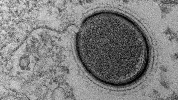 Descubren un nuevo virus gigante de más de 30.000 a?os en Siberia