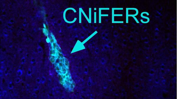 Muestran cómo se forman los pensamientos en el cerebro en tiempo real